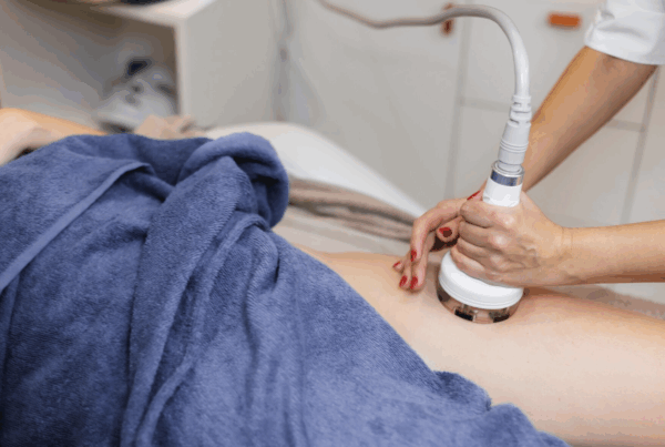 Lipoláser (Liposucción asistida por láser facial y corporal)